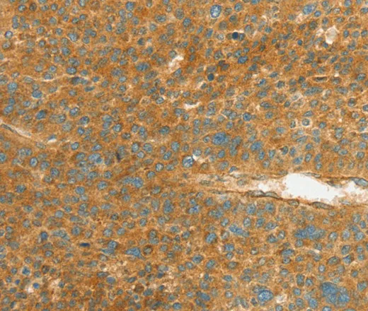 APOL2 Polyclonal Antibody - image 1