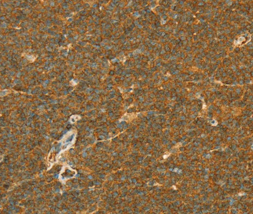 APOL2 Polyclonal Antibody - image 2