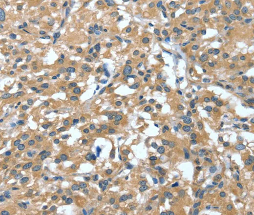 DTX1 Polyclonal Antibody - image 1
