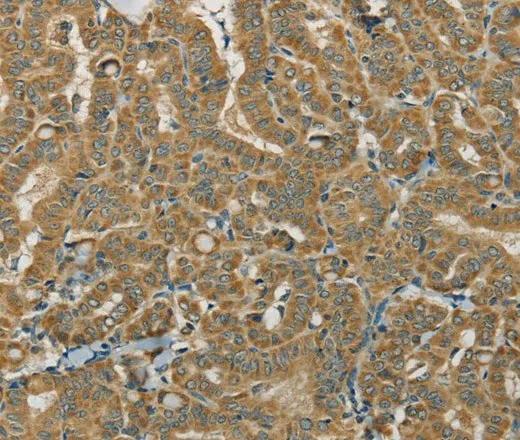 SDHB Polyclonal Antibody - image 1