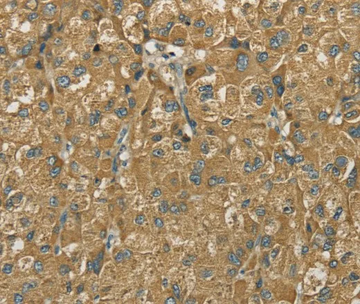 SDHB Polyclonal Antibody - image 2