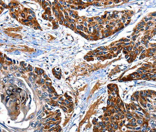 ITGA7 Polyclonal Antibody - image 1