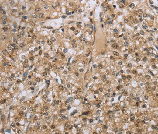 RAB39B Polyclonal Antibody - image 1