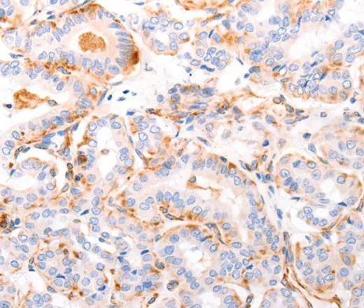 ABCA4 Polyclonal Antibody - image 1