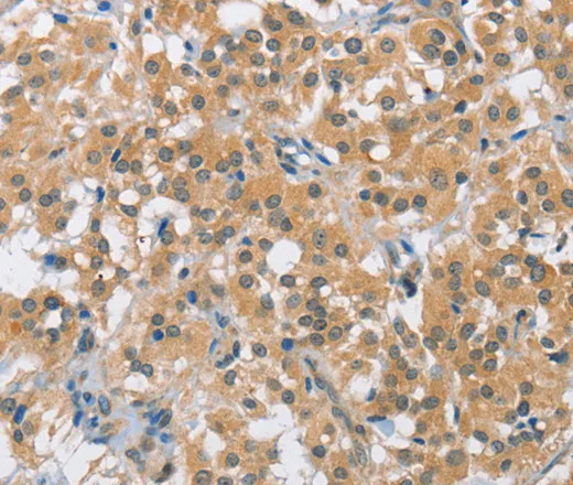 BCL10 Polyclonal Antibody - image 1