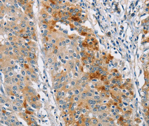 BCL10 Polyclonal Antibody - image 2