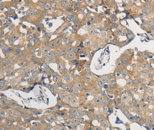 PPP2CB Polyclonal Antibody - image 1