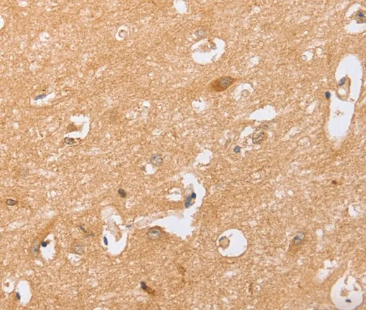 BST1 Polyclonal Antibody - image 1