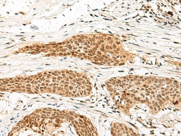 MDFI Polyclonal Antibody - image 1