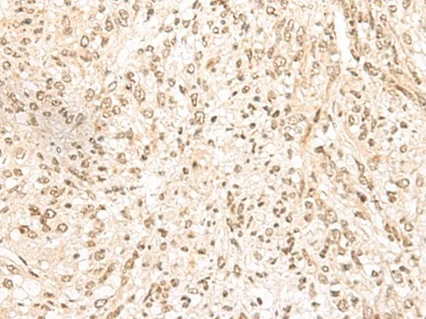 MDFI Polyclonal Antibody - image 2