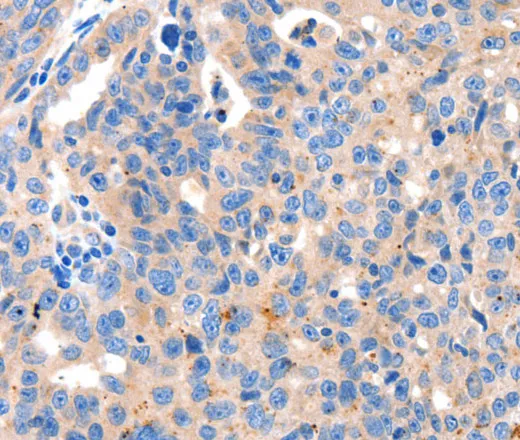 KLK2 Polyclonal Antibody - image 1