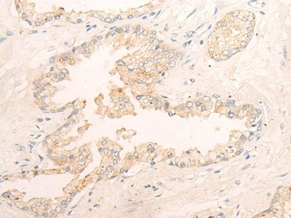 ELANE Polyclonal Antibody - image 1
