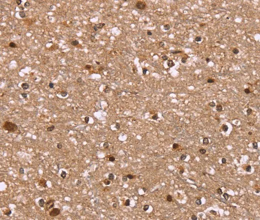 HLTF Polyclonal Antibody - image 1