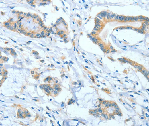ASCC1 Polyclonal Antibody - image 1