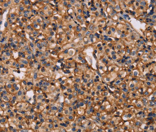 MAP1LC3C Polyclonal Antibody - image 1