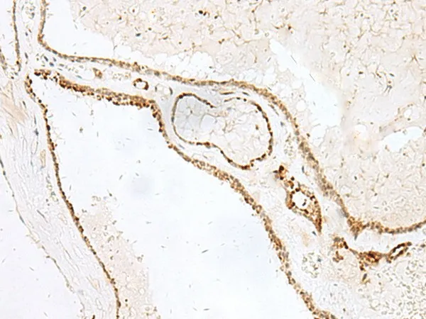 GSKIP Polyclonal Antibody - image 1
