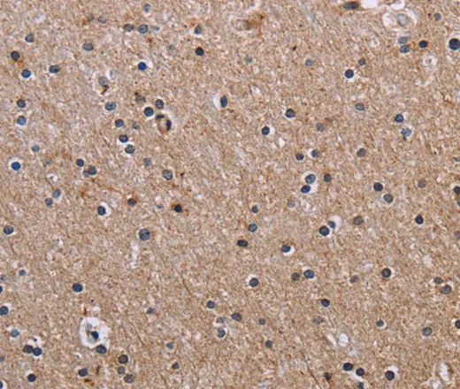 FCGR3A Polyclonal Antibody - image 1