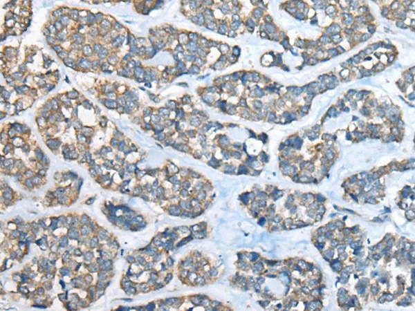 GULP1 Polyclonal Antibody - image 1