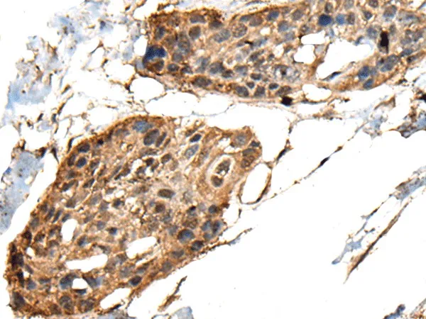 MCPH1 Polyclonal Antibody - image 1