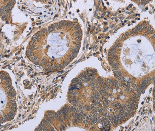 FKBP8 Polyclonal Antibody - image 1