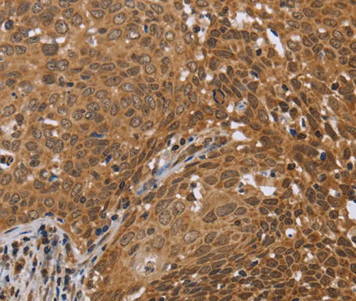 FKBP8 Polyclonal Antibody - image 2