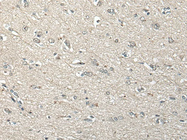 UCN3 Polyclonal Antibody - image 1
