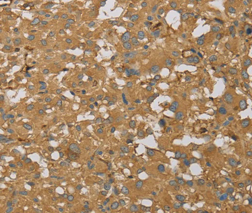 AHSG Polyclonal Antibody - image 1