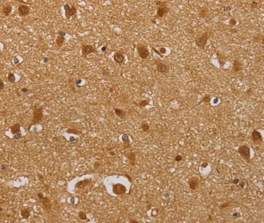 AHSG Polyclonal Antibody - image 2