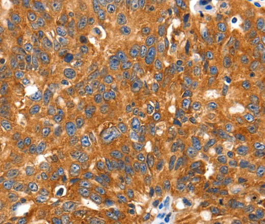 SLC2A2 Polyclonal Antibody - image 1