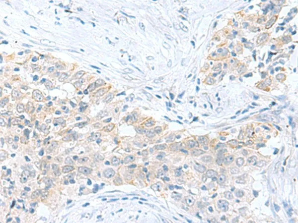 PDE6D Polyclonal Antibody - image 1