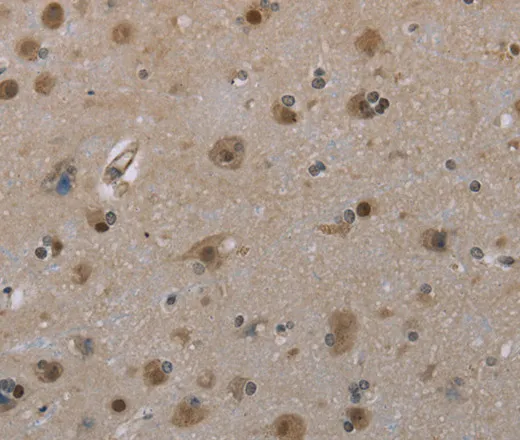 MGLL Polyclonal Antibody - image 1