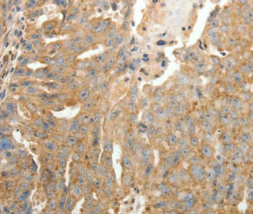 SFTPD Polyclonal Antibody - image 1