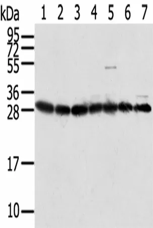RPS3 Polyclonal Antibody - image 1