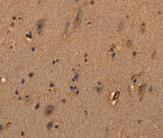 COL18A1 Polyclonal Antibody - image 1