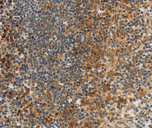 PPP2CB Polyclonal Antibody - image 1