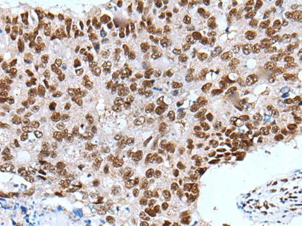 XAB2 Polyclonal Antibody - image 1