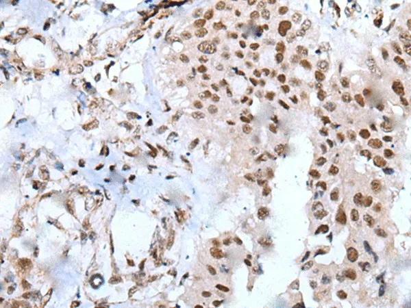 XAB2 Polyclonal Antibody - image 2