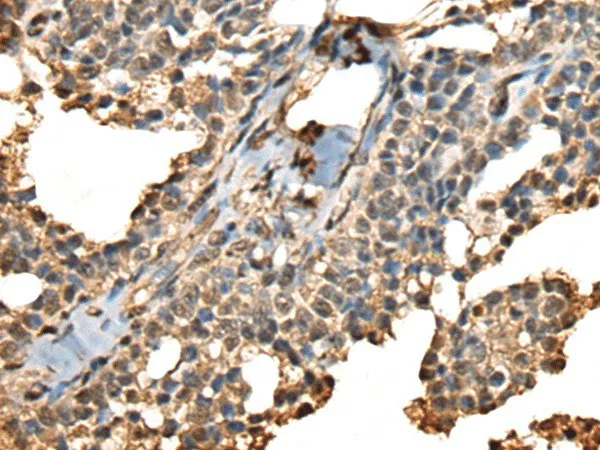 PHF21A Polyclonal Antibody - image 1