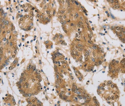 CST6 Polyclonal Antibody - image 1