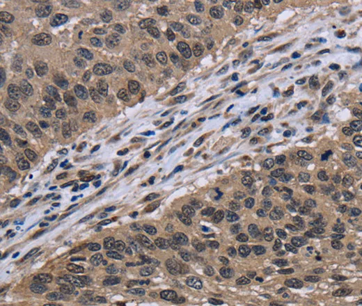 ITGAE Polyclonal Antibody - image 1