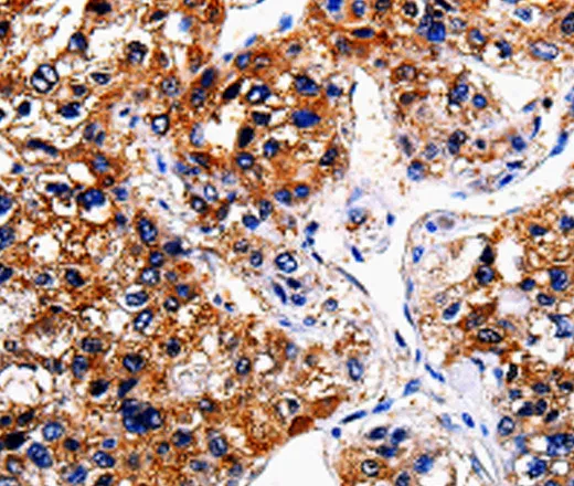 BIRC6 Polyclonal Antibody - image 1