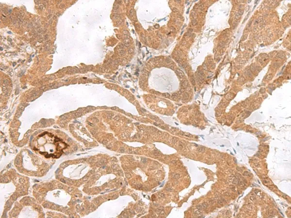 ETV3 Polyclonal Antibody - image 1