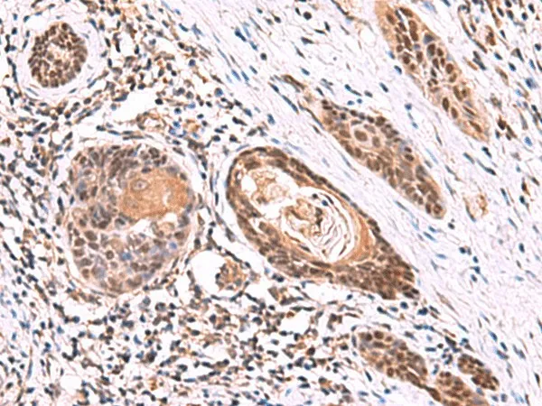 ITPR2 Polyclonal Antibody - image 1