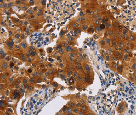 MSLN Polyclonal Antibody - image 1