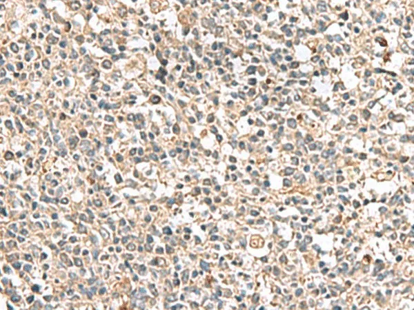 PTPRS Polyclonal Antibody - image 1