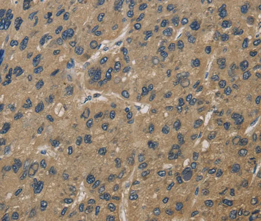 CORO1C Polyclonal Antibody - image 1