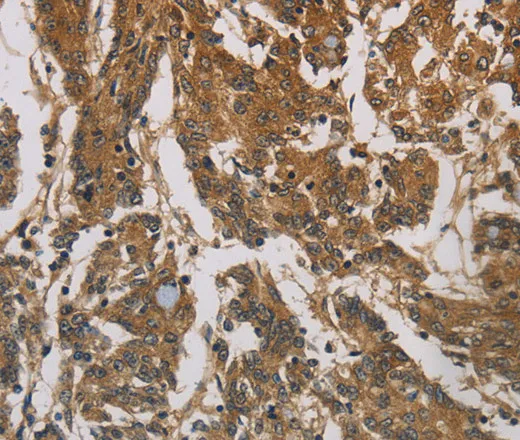 CORO1C Polyclonal Antibody - image 2