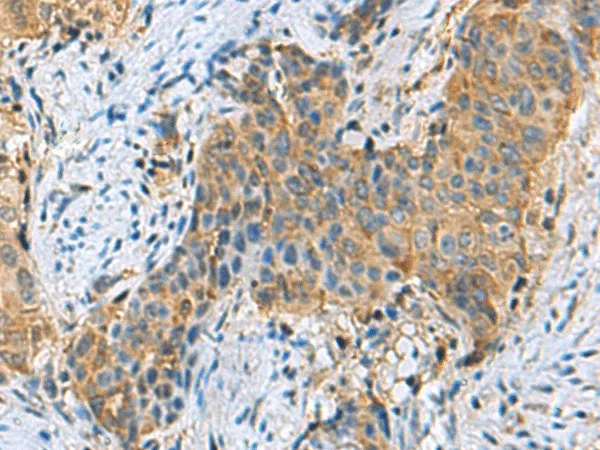PSMA6 Polyclonal Antibody - image 1