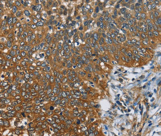 CAST Polyclonal Antibody - image 1