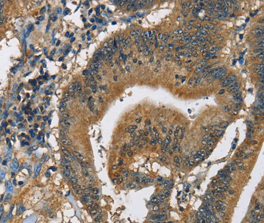 CAST Polyclonal Antibody - image 2